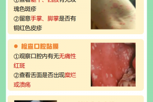 南京:共发现17例阳性患者〃南京确诊17例