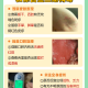 南京:共发现17例阳性患者〃南京确诊17例