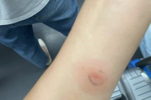 【江苏徐州13人复核阳性/徐州 阳性】