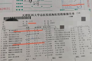 【济南新增1例本土确诊病例/济南新增确诊病例23例】