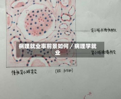 病理就业率前景如何／病理学就业