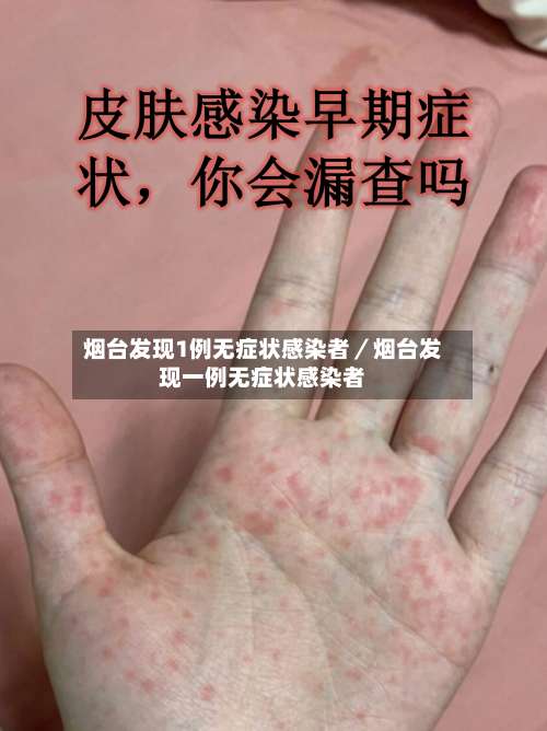 烟台发现1例无症状感染者/烟台发现一例无症状感染者-第1张图片