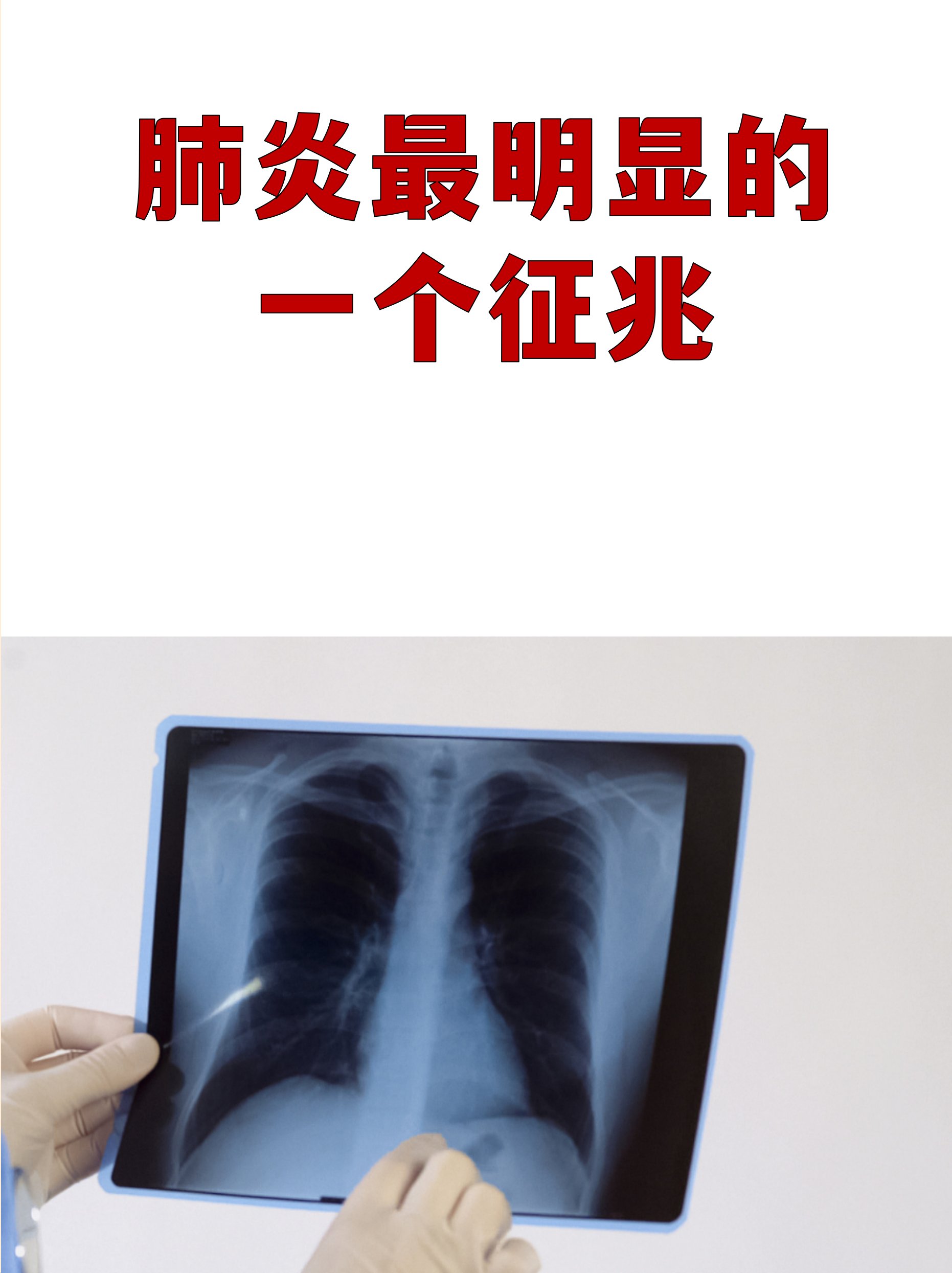 锦江区疫情,锦江区新增新型冠状病毒-第2张图片